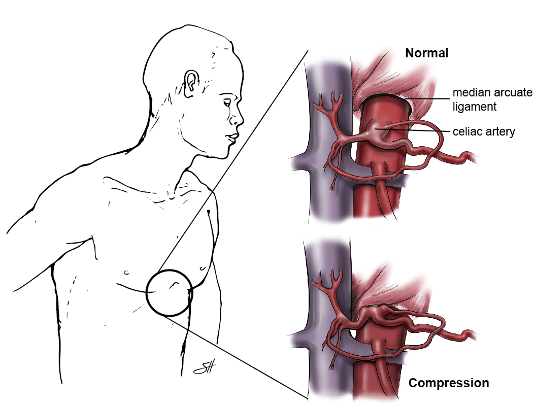 Compression Wear · Dunbar Medical