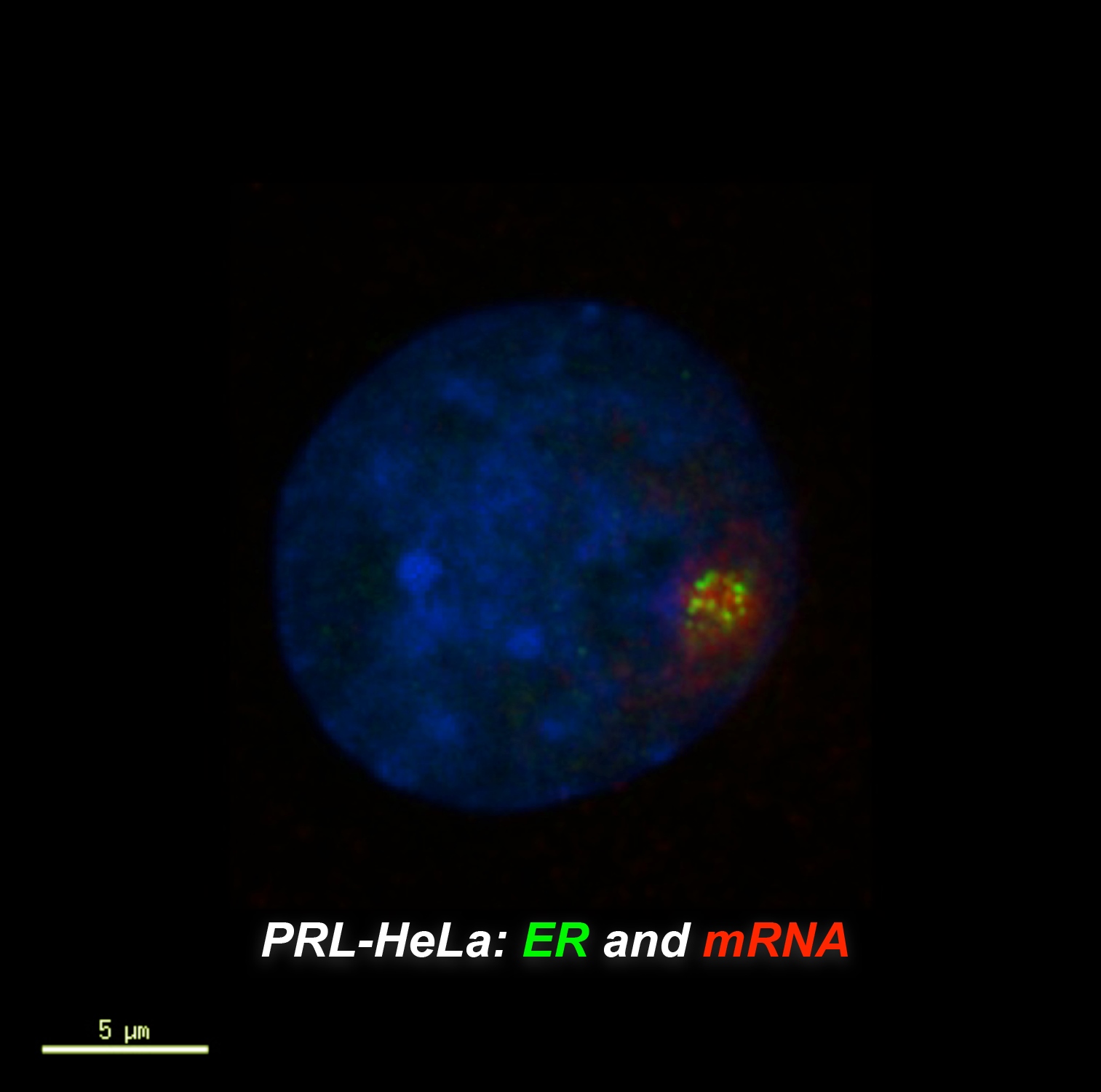 In this image of a cell in culture, the estrogen receptor is in green the messenger RNA is in red. 