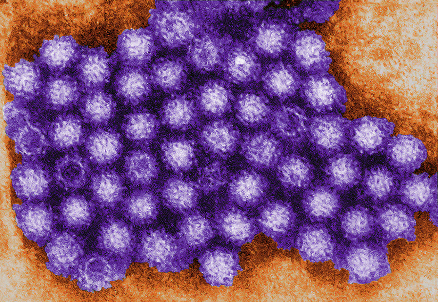 Transmission electron micrograph of a norovirus. Courtesy of the Centers for Disease Control and Prevention 