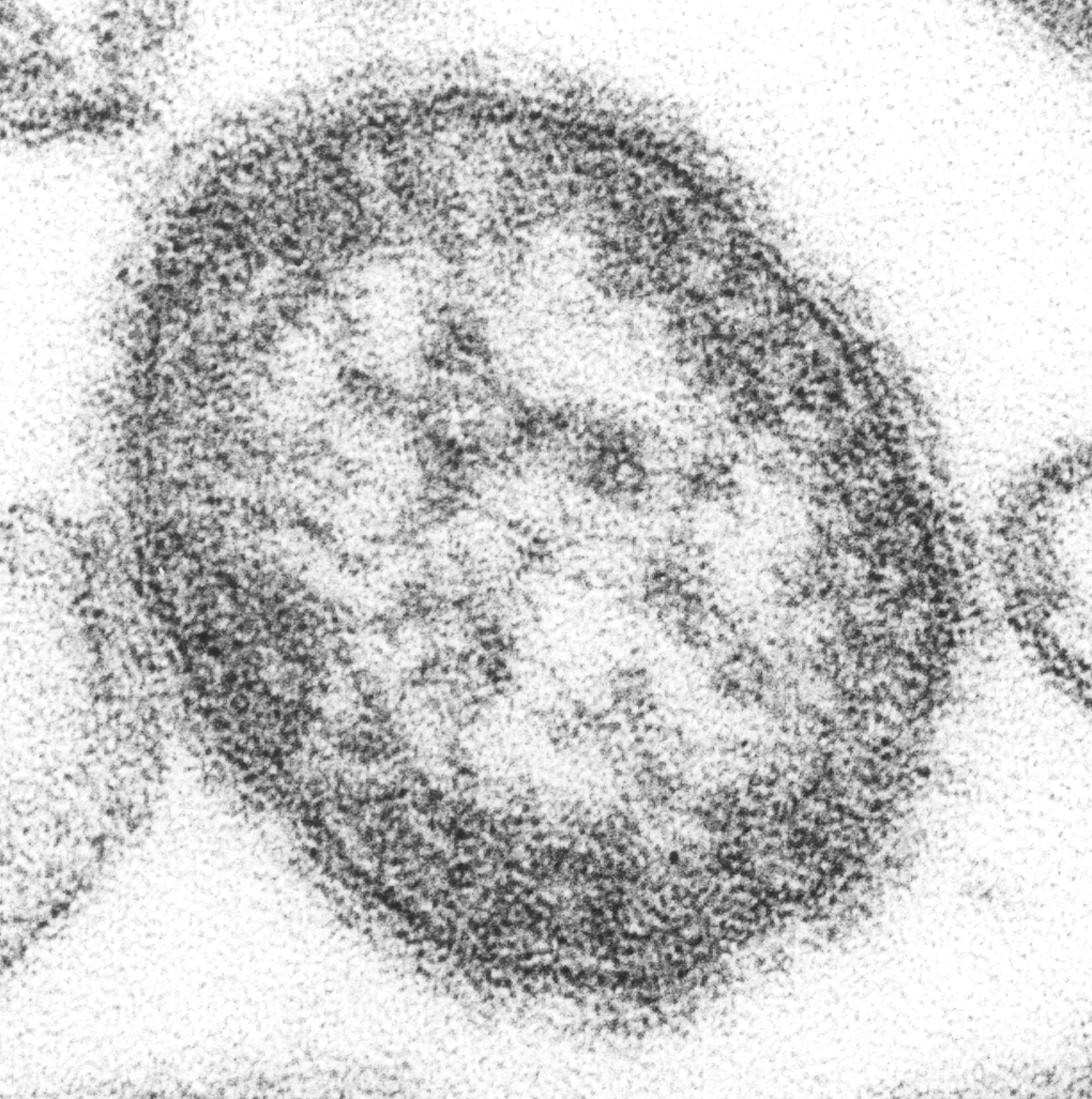 Electron microscope of single measles virus particle. Credit: Cynthia Goldsmith, U.S. Centers for Disease Control and Prevention