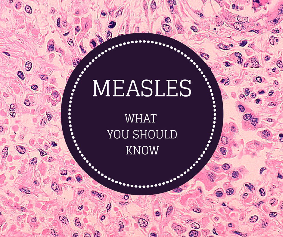 Measles