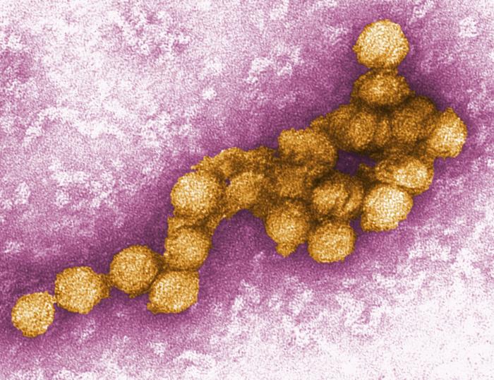 Digitally-colorized transmission electron micrograph of the West Nile virus courtesy of the Center for Disease Control and Prevention.