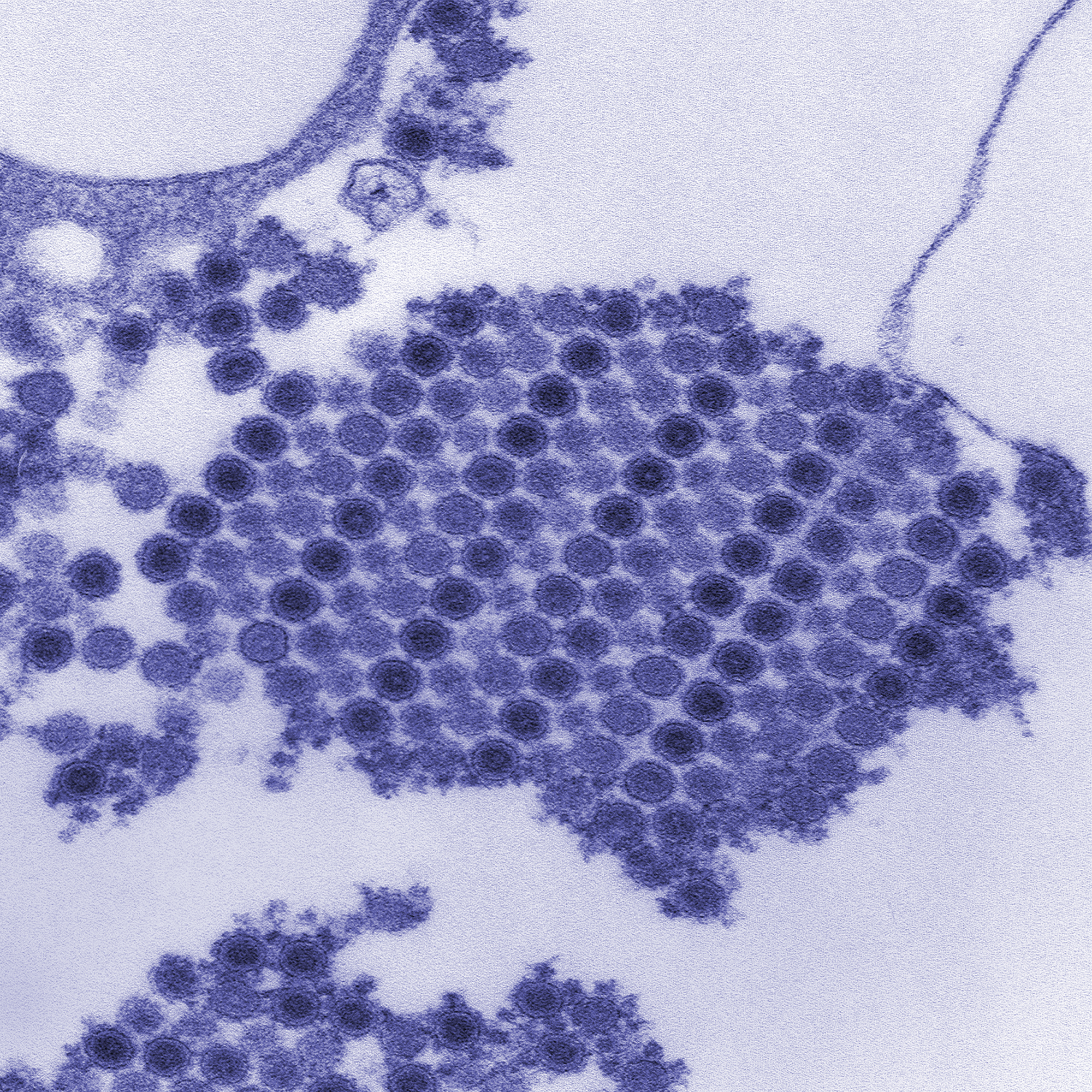Transmission electron micrograph depicts numerous Chikungunya virus particles. Image courtesy of the Center for Disease Control and Prevention.