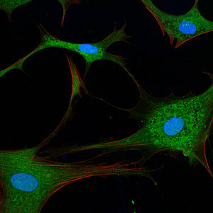 Cells in autophagy. Photo courtesy Sarah Pfau, Massachusetts Institute of Technology, Princeton University