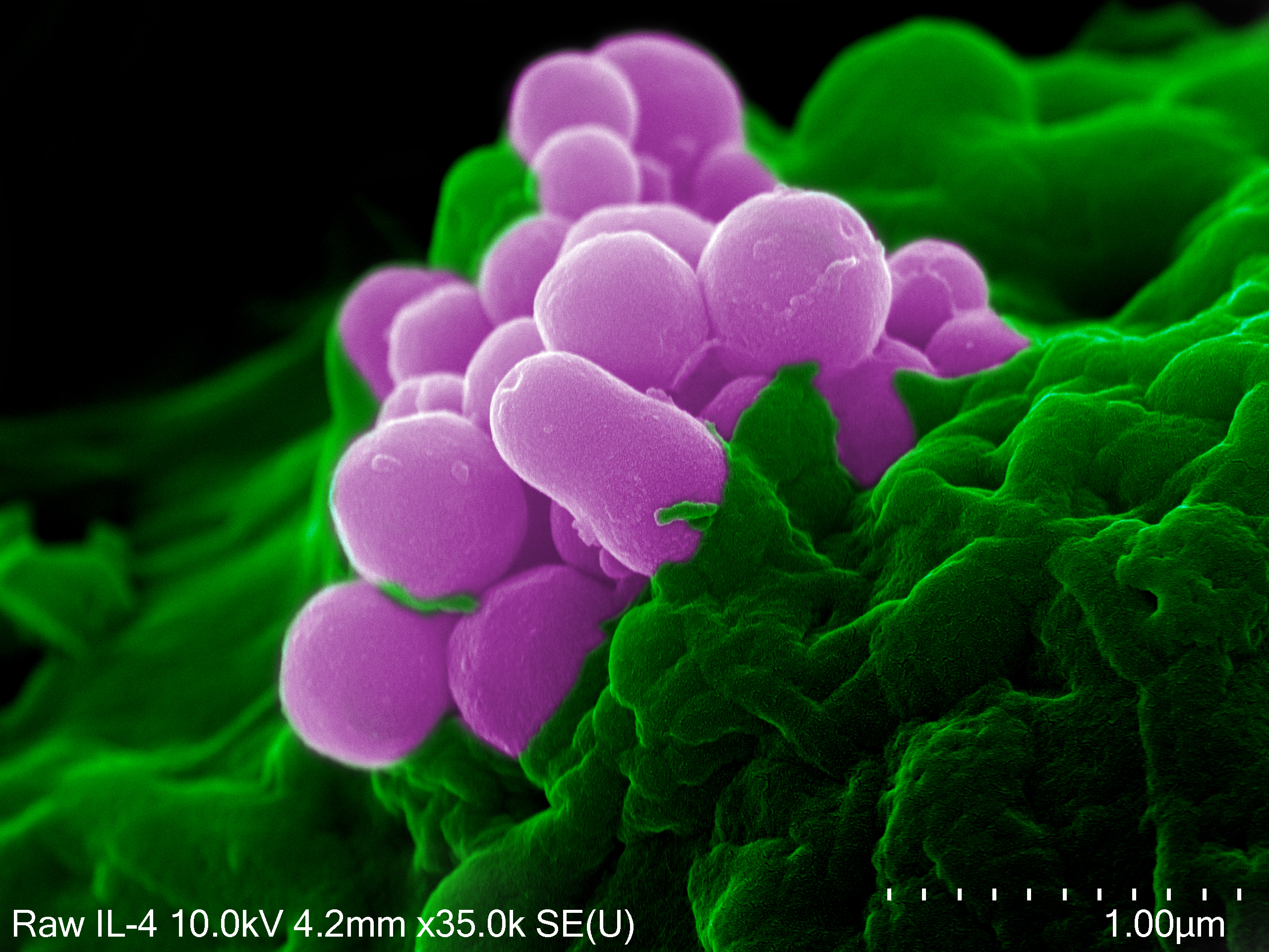 Cell-based trafficking of nanoparticles is achieved through in situ uptake and transport of nanoparticles by myeloid cells. Shown here is the cell membrane of a macrophage, pseudo-colored in green, in the process of internalizing silica nanoparticles, pseudo-colored in pink. Photo by Rita Serda, Ph.D. and courtesy of Scott C. Holmes 