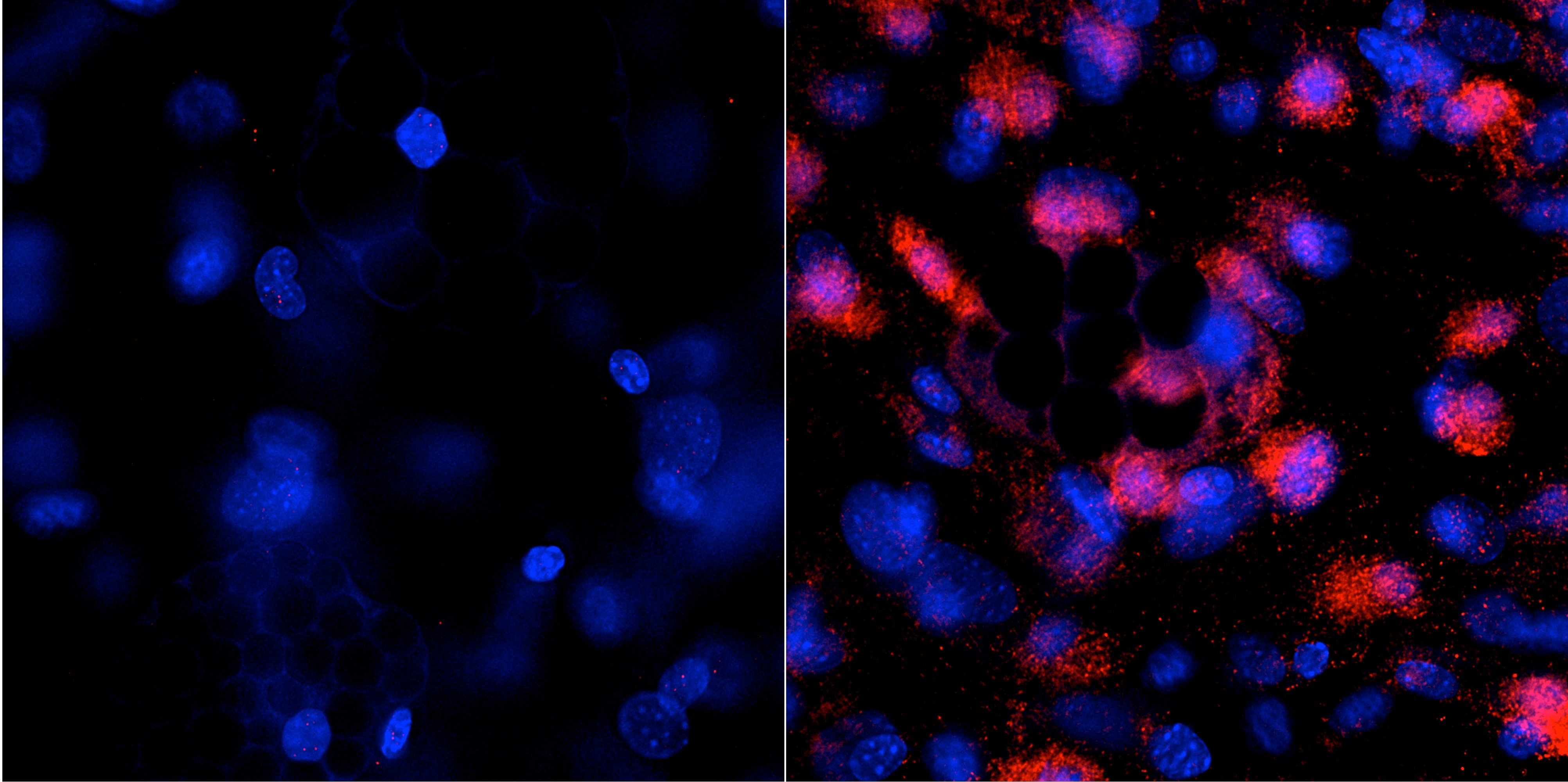 Cell culture of white adipocytes, right treated with drug. Stained for ucp1 (uncoupling protein 1)( 