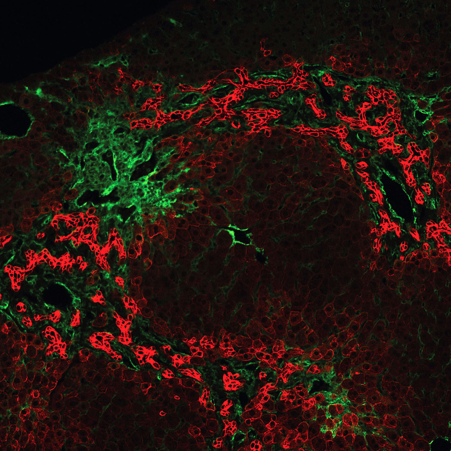 A hepatic lobule from an adult Jag1 heterozygous mice stained for wide- spectrum cytokeratin (red) and alpha smooth muscle actin (green) shows extensive ductular reactions in the periportal areas. 