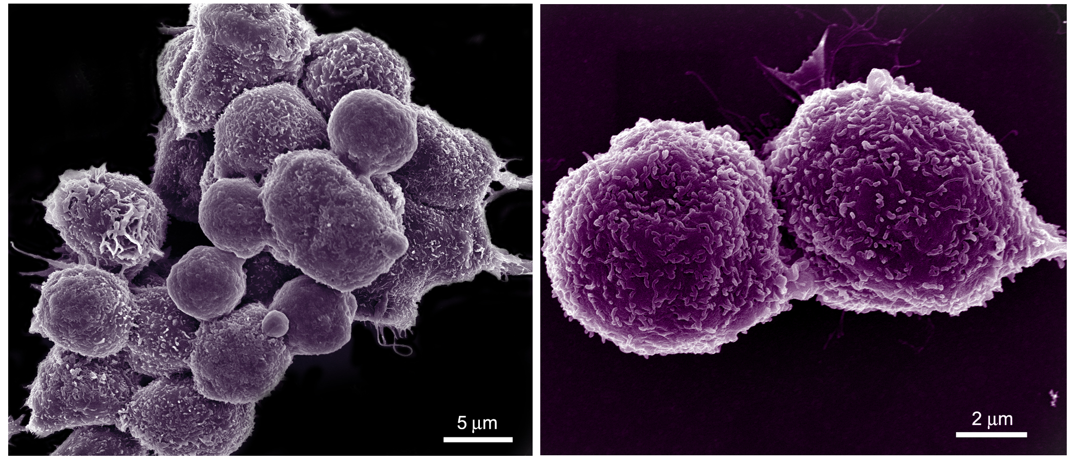 mouse breast cancer cells