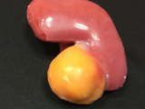 3D-kidney-featured-photo