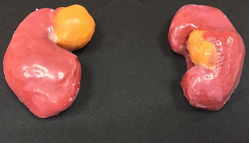 3d-kidney-models