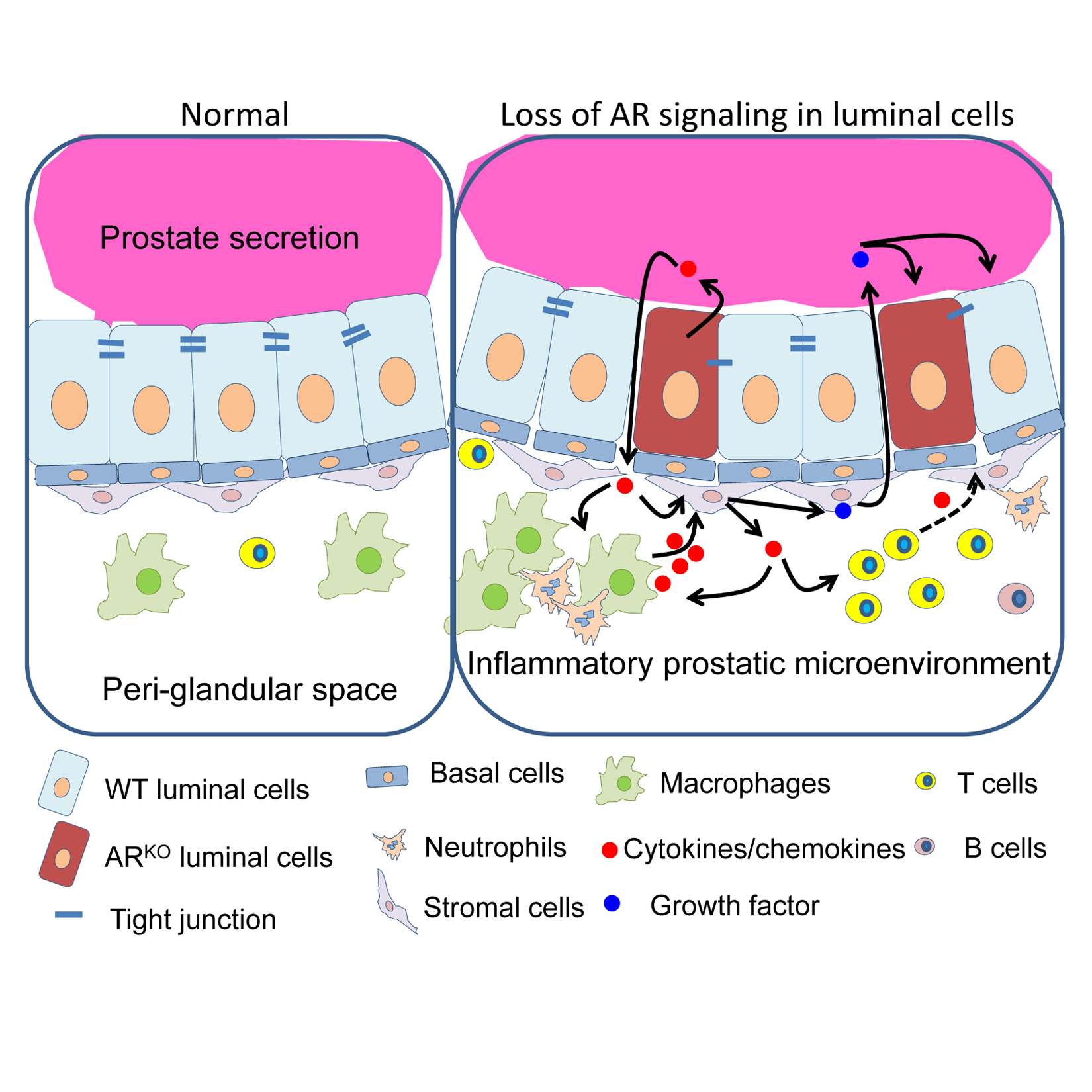 Benign Prostatic Hyperplasia Pathophysiology Diagram