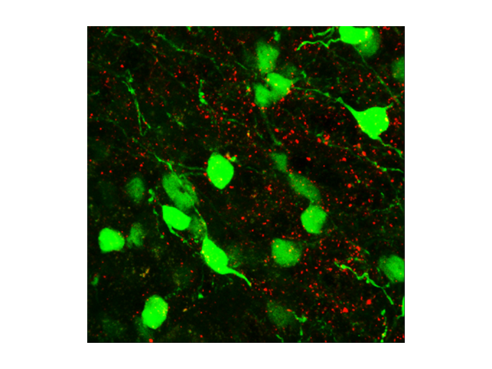 Higher magnification of diagonal band of Broca difuse cholinergic projections into the hypothalamus. Pro-piometanocortin (green); cholinergic terminals (red). B. Arenkiel/Nature, 538:253, 13 Oct. 2016.