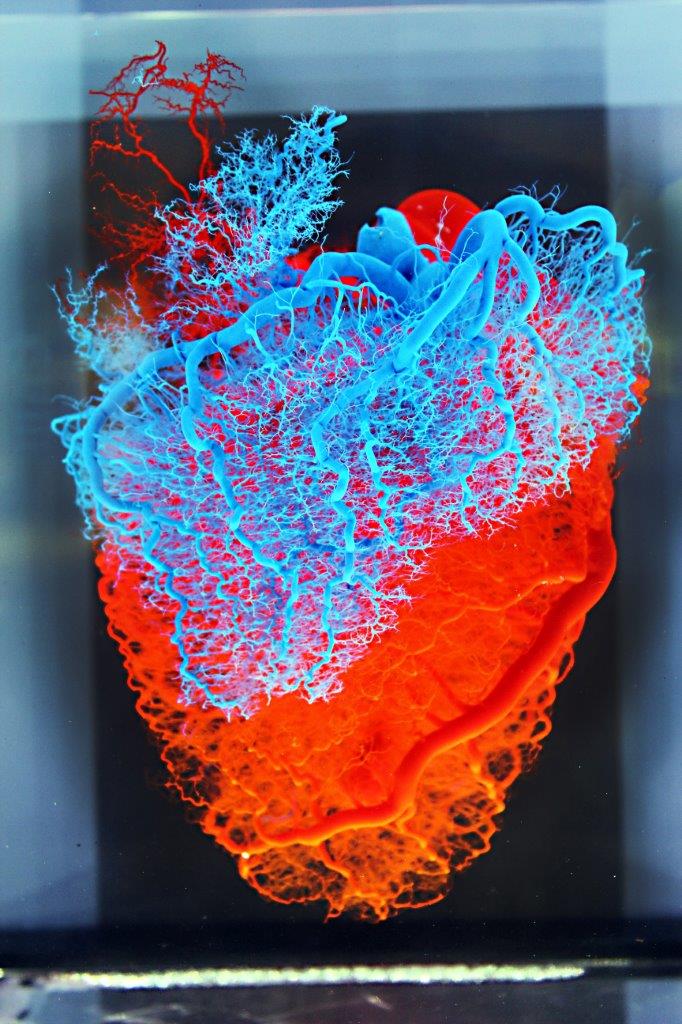 heart-veins-and-arteries-med-museum