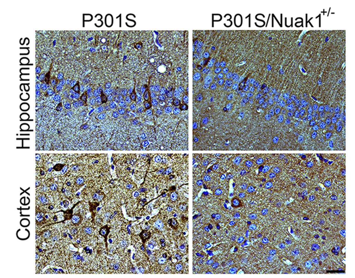 Brain section from mouse carrying the dementia-causing P301S mutation in human tau shows accumulation of tau neurofibrillary tangles (in dark brown, left). When Nuak1 levels are decreased by 50% (P301S/Nuak1+/-; right), fewer tau tangles accumulate. Courtesy Cristian Lasagna-Reeves/Zoghbi lab.