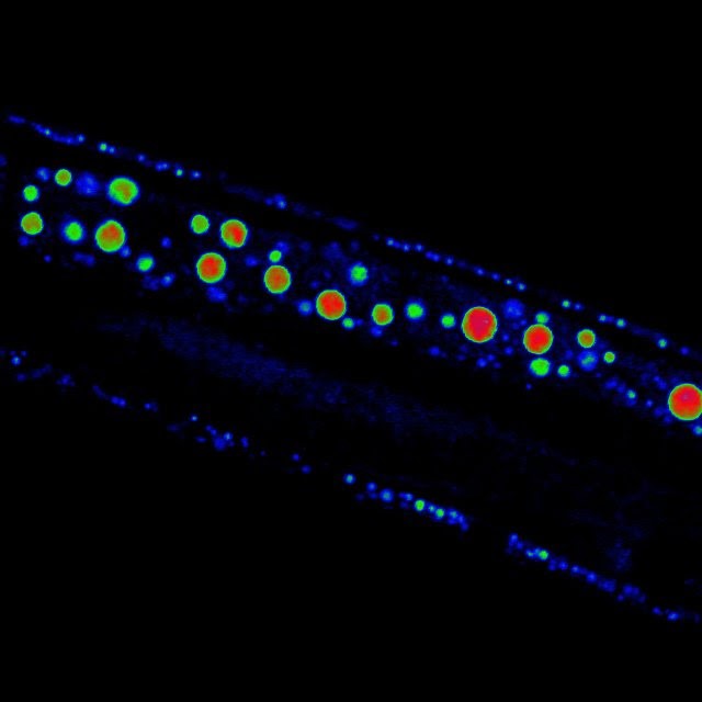 Circadian clock in heart failure