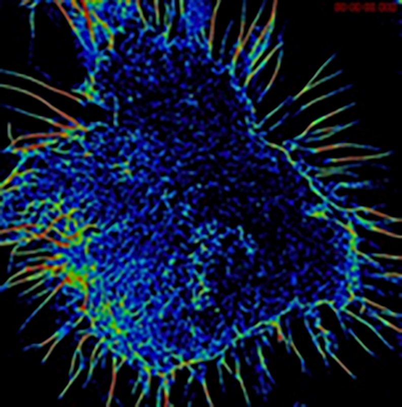 Image of the Month: An activated human NK cell - Baylor College of ...