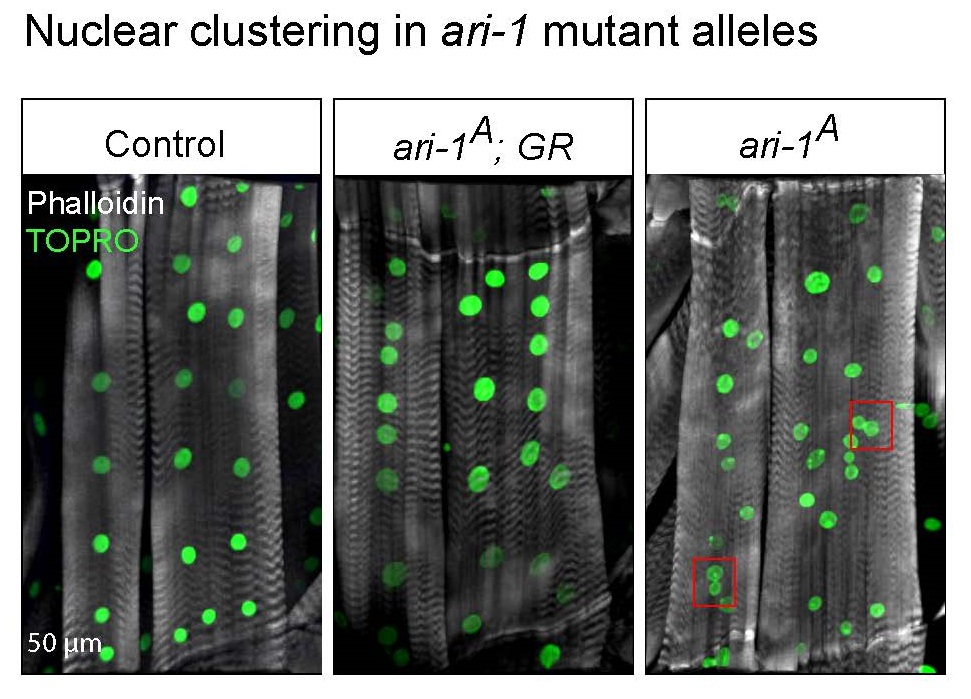 Image of the Month: Fruit flies and humans - Baylor College of