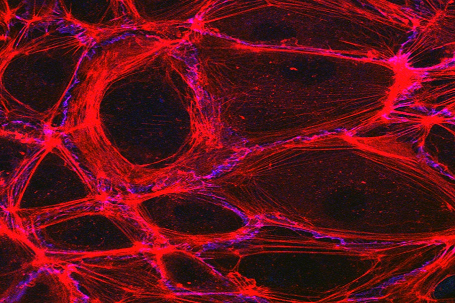 The Dark Side Of Antibiotic Ciprofloxacin