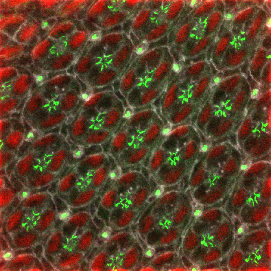 Snapshot of eye development in the fruit fly