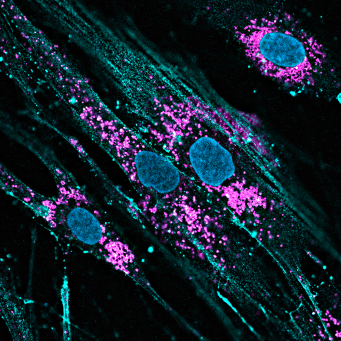 Solving the mystery of CLN8’s connection to Batten disease