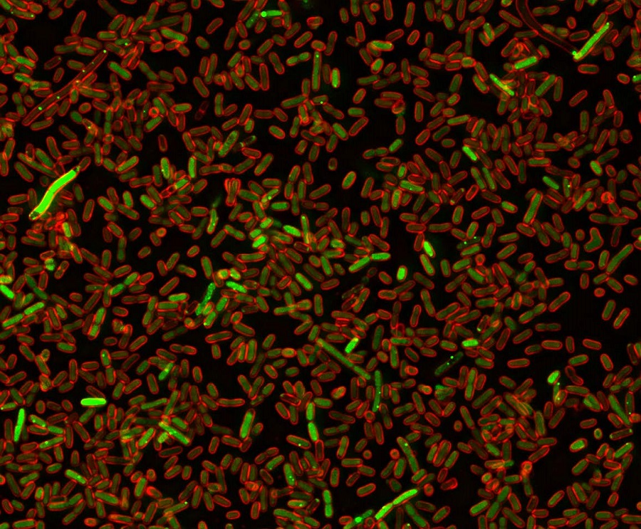 E Coli Shows The Way To Discover Cell Made Protein Carcinogens