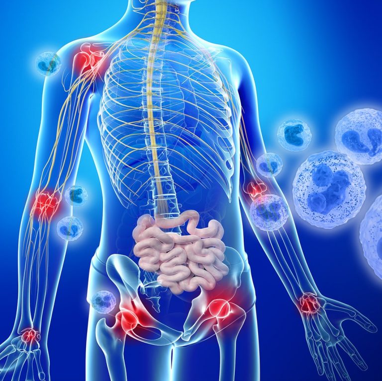 osteoarthrits of the hip free clinical trials