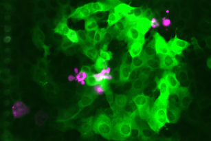 Still image to accompany July 2019's Video of the Month (Hyser lab) Cells expressing a fluorescent calcium sensor (green) were infected with rotavirus, a virus that causes acute gastroenteritis. The rotavirus-infected cells (pink) trigger an intercellular calcium wave that increases calcium in surrounding uninfected cells. (Scale bar = 100 μm; courtesy of the Hyser lab).