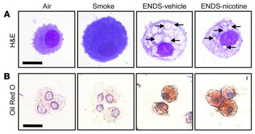 E cigarettes disrupt lung function and raise risk of infection