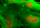 How neutrophils help triple-negative breast cancer cells spread to other organs