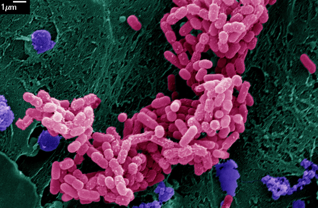 Image Of The Month E Coli Bacteria Growing On Mini Guts   1 EAEC  Color 7 Maresso Use This Post 1024x669 