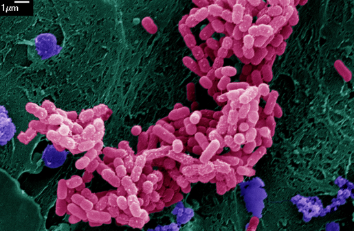 e coli bacteria