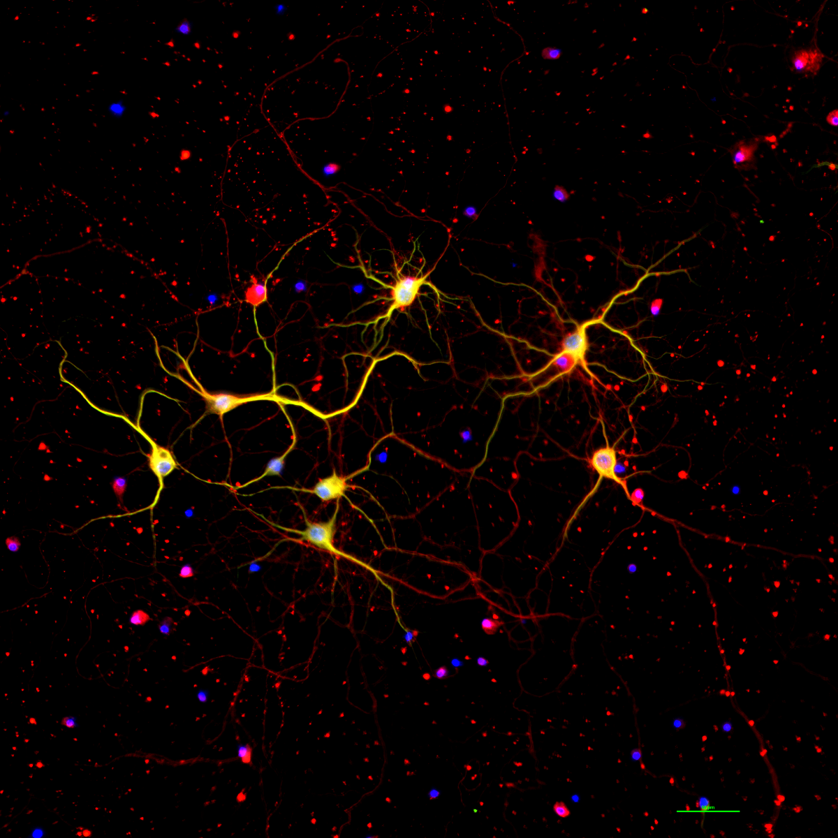 Close up of neurons from the brain cortex of a mouse with Huntington's disease. 