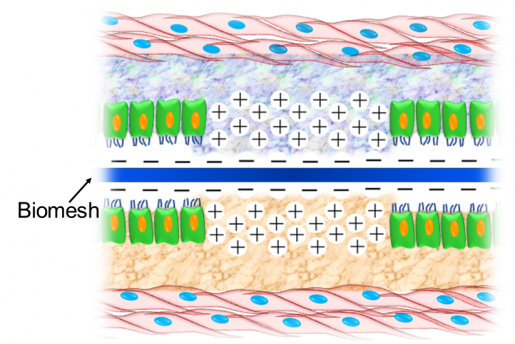 Implantation of a negatively charged Biomesh captures positively charged proinflammatory cytokines from the damaged peritoneum after surgical trauma. Image credit: Scott Holmes, CMI.