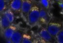 Fatty acids promote immune suppression and therapy resistance in triple negative breast cancer