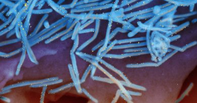 FROM THE LABS: Human ‘mini-noses’ help understand why RSV infections are more severe in children than in adults