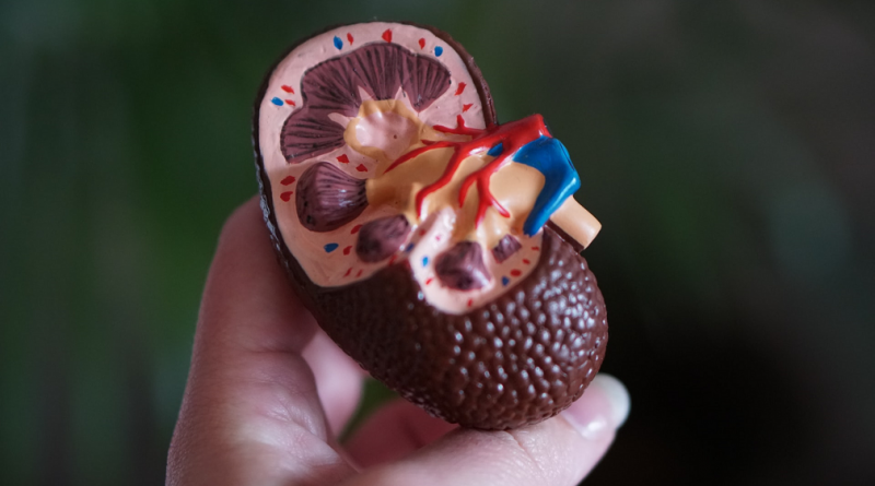 kidney-model