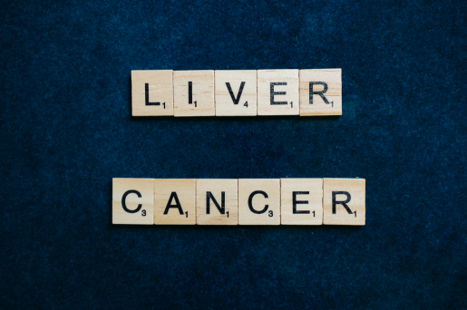 liver-cancer-image