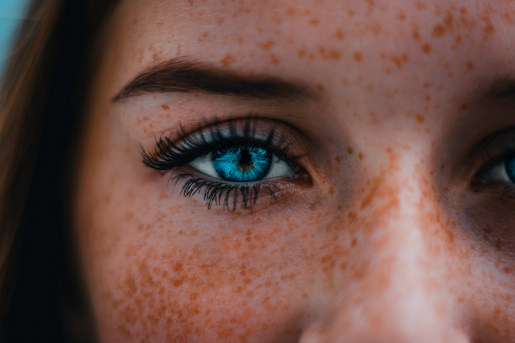 woman-with-freckles-eyelashes