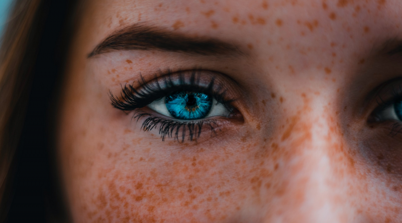 woman-with-freckles-eyelashes