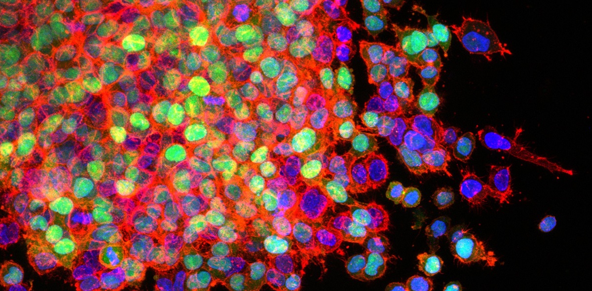 FROM THE LABS: A safe house for tumors: method reveals cellular makeup of tissues that favor metastatic cancer growth