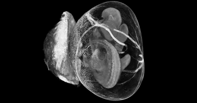 Image of the Month: Mouse embryo inside the yolk sac