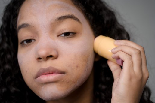 An adult applies a treatment for acne on their face.