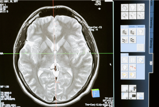 Brain imaging tests for chronic pain: medical, legal and ethical