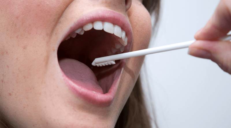 A person with their mouth open wide having their DNA collected via a mouth swab.