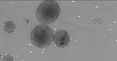 A grey microsopy image with several dark grey circular blods, representing breast cancer spheroids.