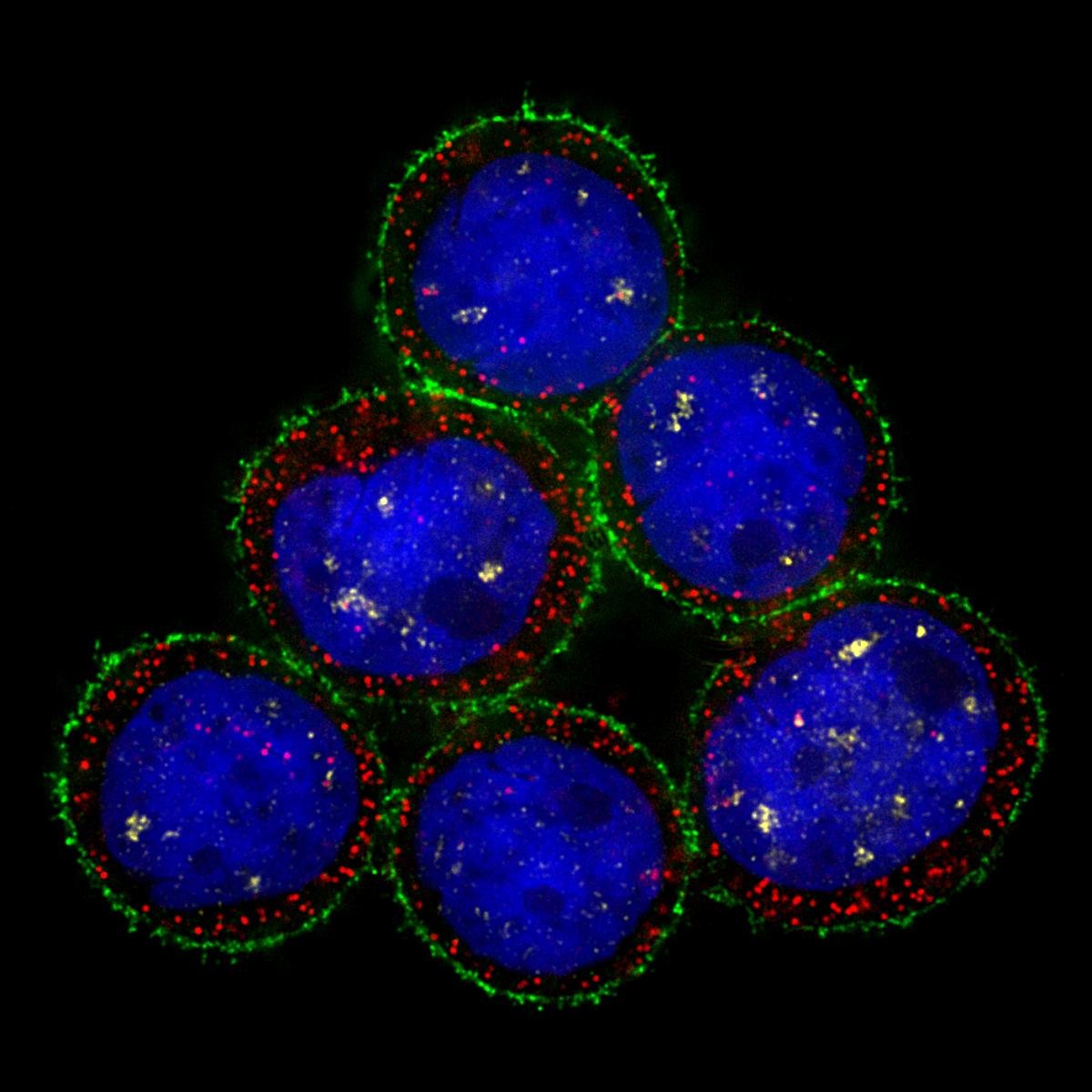 How Do Breast Cancer Cells Attack The Body And Spread