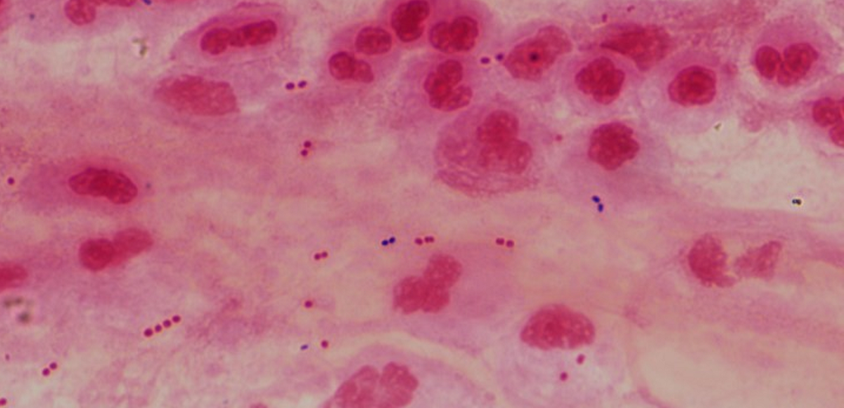 bacterial pneumonia cell