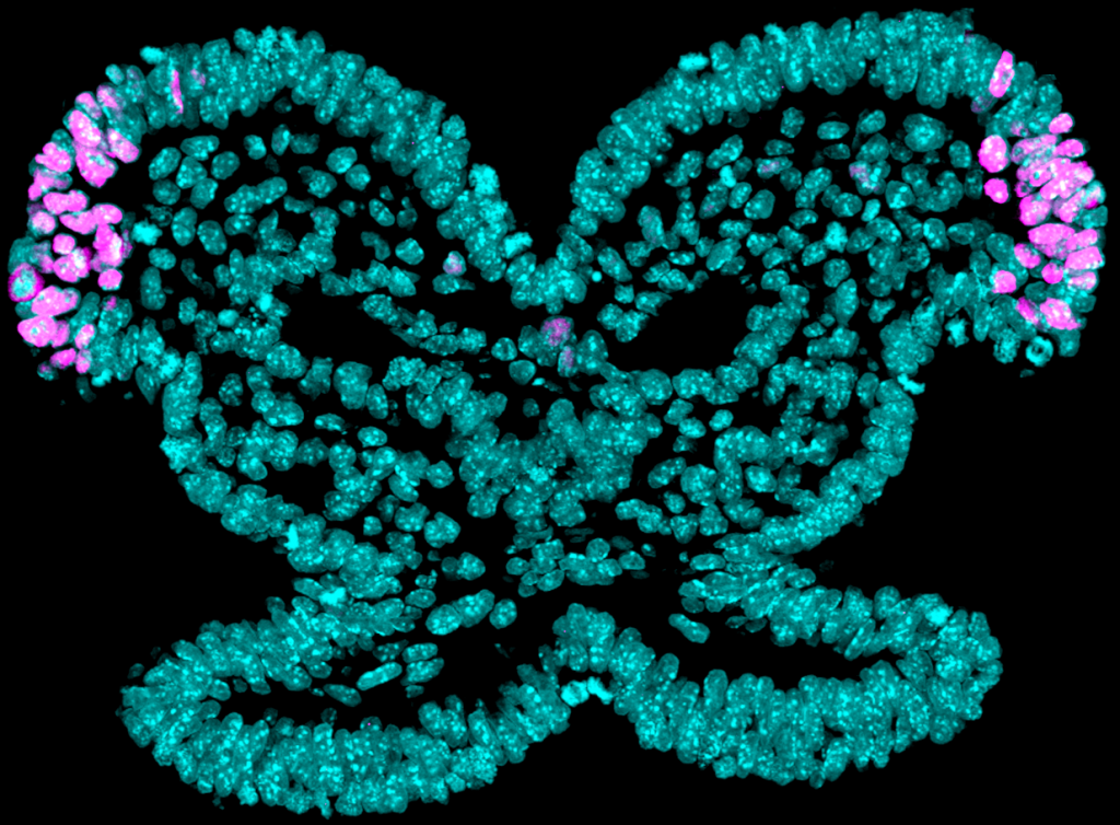 Better understanding of craniofacial birth defects opens new roads for