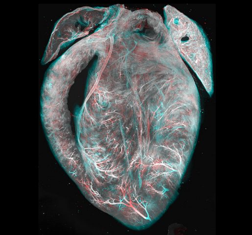 An image of a transparent research model heart. The blood vessels are labeled with perfused lectin and processed with tissue clearing protocol EZ Clear to render the whole heart optically transparent for imaging.