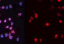 Discovering targetable vulnerabilities in endocrine therapy-resistant breast cancer